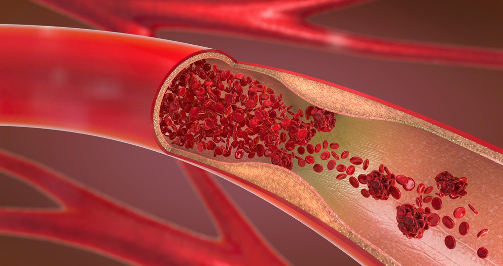 Bloed, hematologie