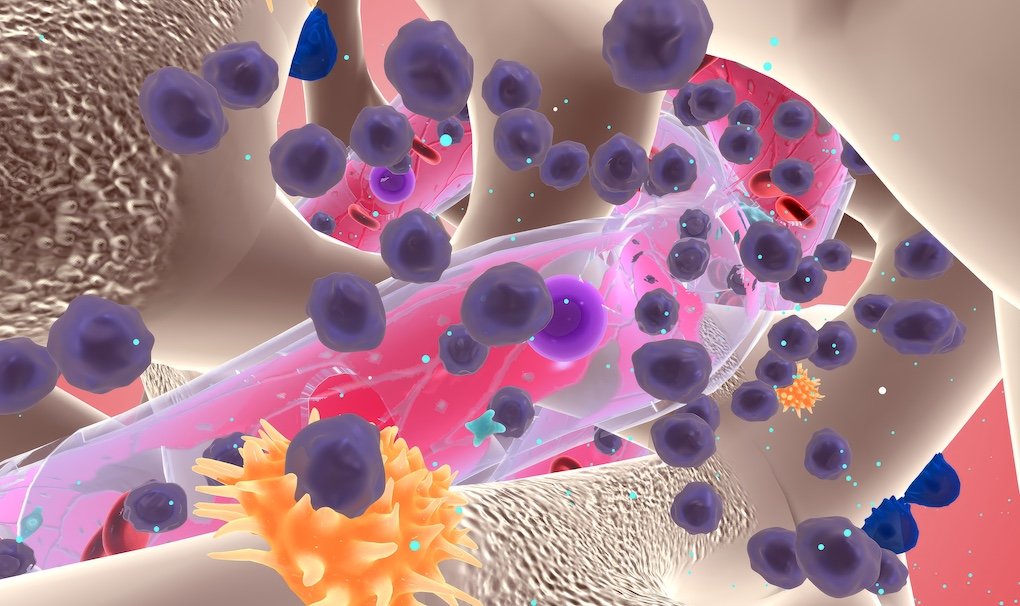 Multipel Myeloom, hematologie