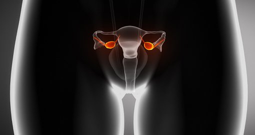 Ovarium, eierstokken, cervix, gynaecologie